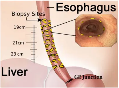 Figure 2.2: Seattle protocol based quadrant biopsies.