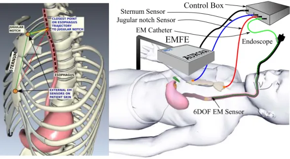 Figure 3.2: System setup: Placement of sensors, patient position and other device setup in the operating room.
