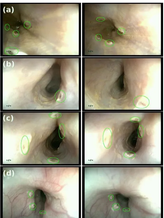 Figure 3.5: The figure shows results from interventions performed on pigs. The 1 st column shows the frames from the video frames from a SE, the 2 nd column shows the closest match found from a DE obtained using the video synchronization presented in Secti