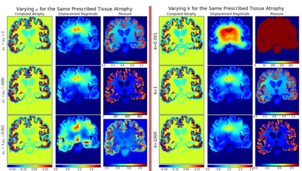 Figure 2.7: The prescribed atrophy is a uniform atrophy only in the cortex. Left: