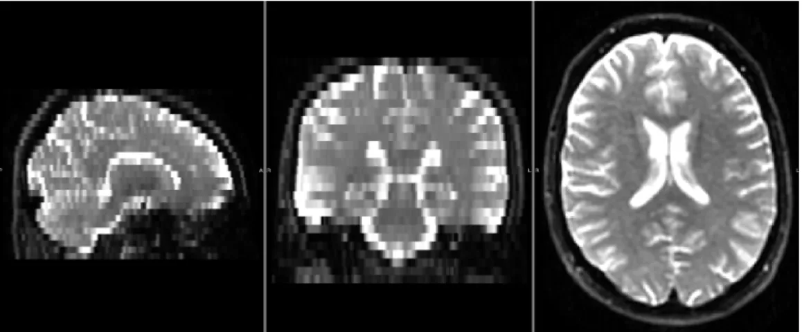 Figure 1.4: An example of B0 (undiﬀused) image acquired during a routine clinical DTI acquisition