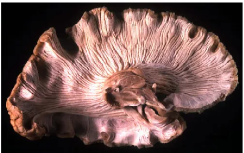 Figure 2.10: White matter ﬁbers emanating out of the thalamus towards the cere- cere-bral cortex