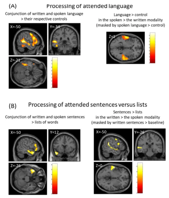 Fig. 2 e Whole-brain analyses of the activations evoked by language when it is attended