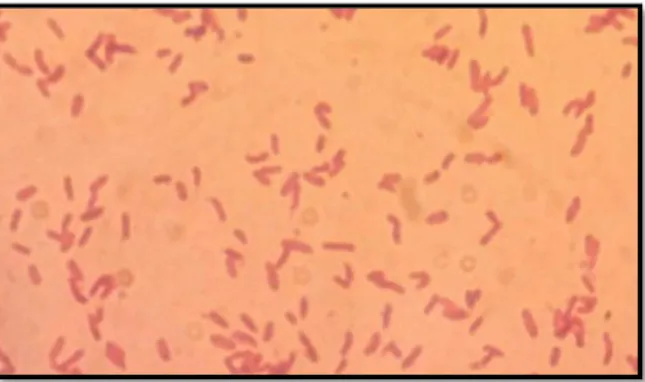 Figure 13 : Observation microscopique (x1000) des Pseudomonas après une coloration de  Gram