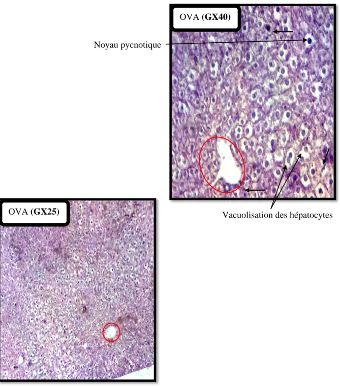 Figure 15 :  Observation au microscope optique à deux différents grossissements des coupes  histologiques du foie des souris  immunisées à l’OVA