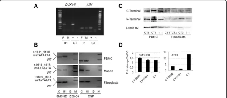 Fig. 4 DUX4 expression and characterization of the SMCHD1 mutation by RT-PCR and western blotting