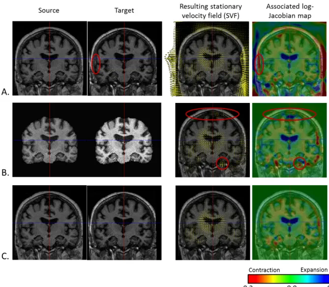 Figure 2.4: Comparison of three non-linear dieomorphic registration methods: