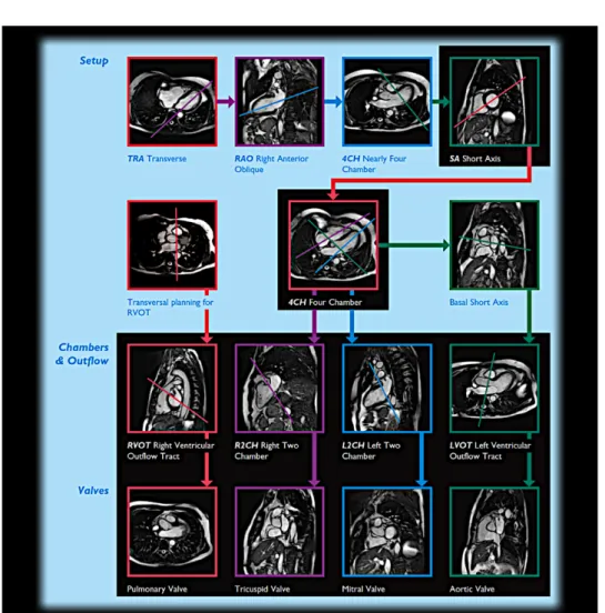 Figure 1.12: Different views of the heart acquired using Cardiac MRI and their relations with either a focus on the ventricles or the valves