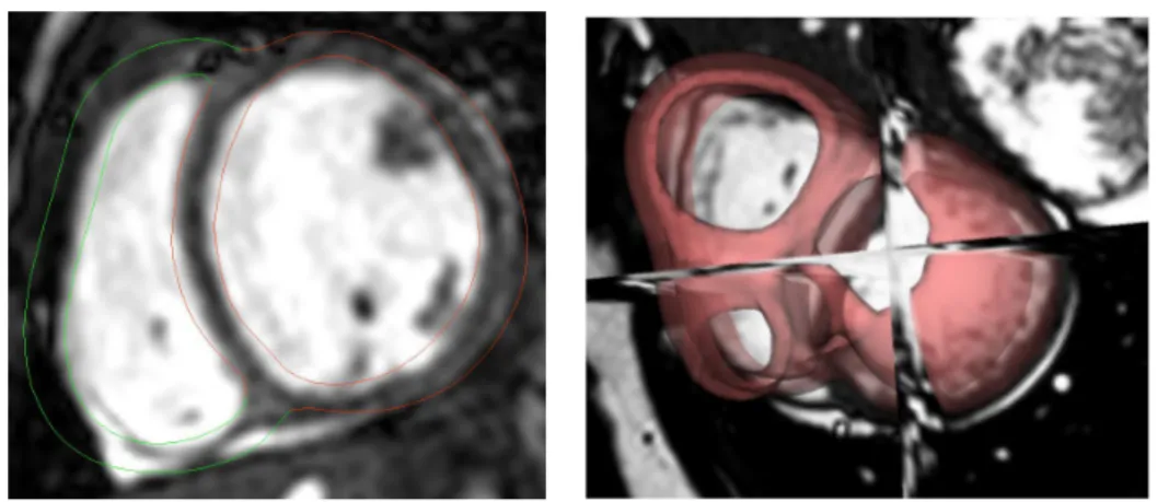 Figure 2.2: Two example of shapes from segmentation of cardiac images. (Left):