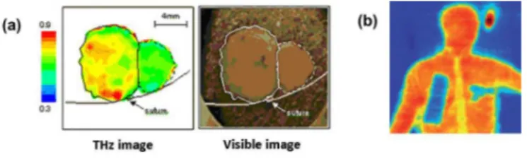 Fig. 2: (a) Terahertz imaging revealing epithelial can- can-cer (red areas), not detected in visible imaging (source: