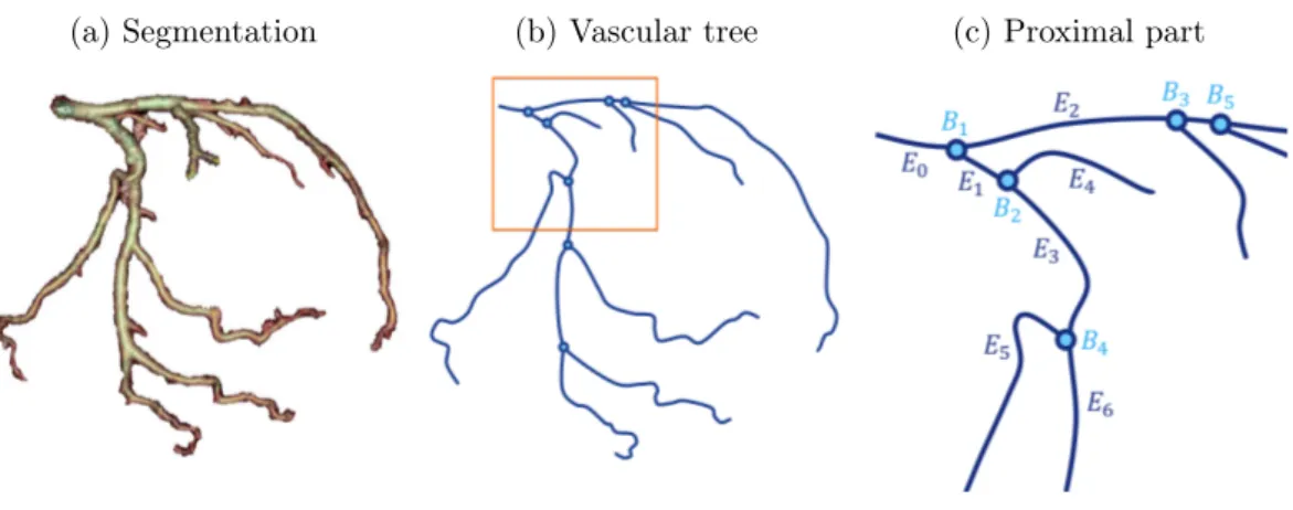 Figure 4.5: Vascular tree representing the coronary arteries. (a) segmentation of the arteries, (b) sparse tree representation with proximal part squared in orange, (c) zoom on the proximal part of the tree structure.
