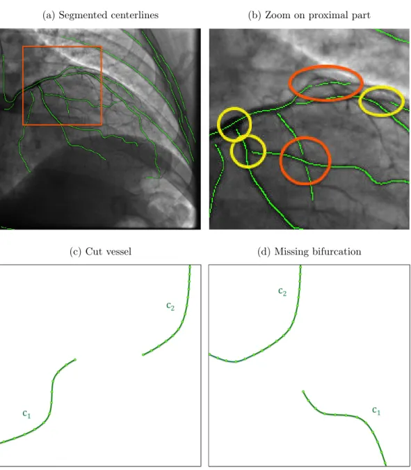 Figure 4.13: Segmented centerlines before the reconnection procedure on the whole image (a)