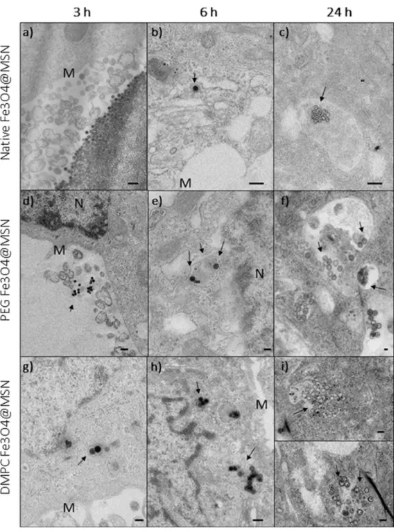 Figure 6. Transmission electron microscopy imaging of HepG2 cells exposed for 3, 6, and 24 h at   50  μg mL −1  for (a–c) native, (d–f) polyethylene glycol (PEG)-coated, or (g–i) dimyristoyl  phosphatidylcholine (DMPC)-coated Fe 3 O 4 @MSN