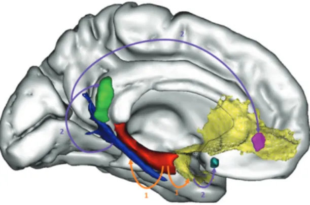 Fig. 6. Distant relationships between atrophy and hypometabolism in AD. Using original methods especially developed for this  pur-pose, we showed that hippocampal atrophy (red) was at least partly responsible for the disruption of white matter fibers (the 