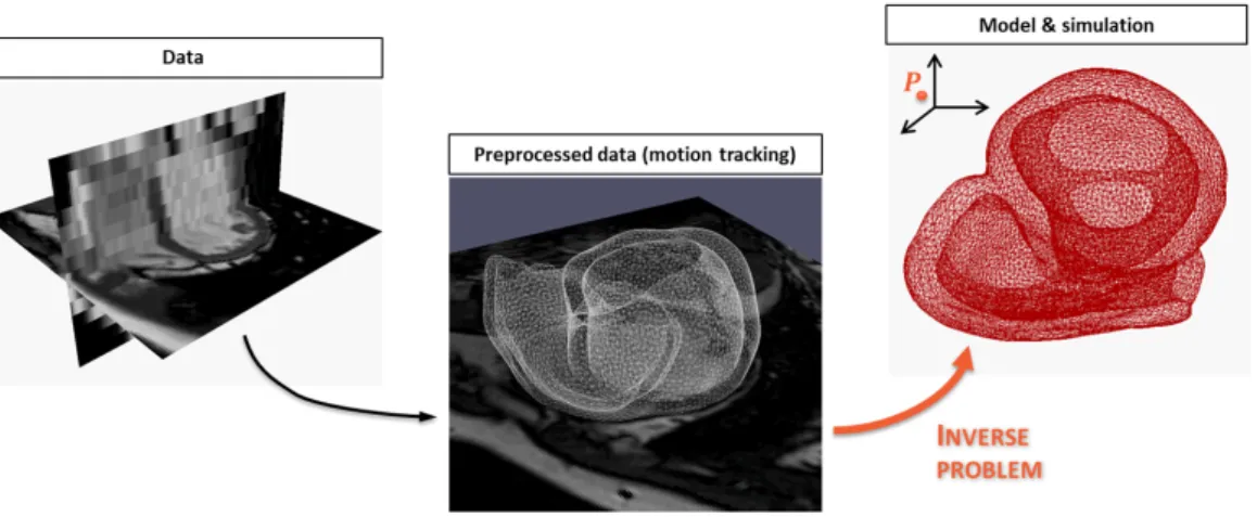 Figure 1.4: From patient-specific images to a personalized simulation: an inverse problem This inverse problem has been tackled by different authors over the last five years.