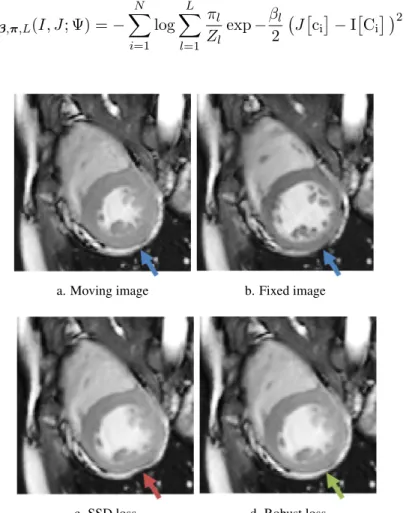 Figure 3.3: We illustrate the appeal of a robust variant of the SSD image loss based on a mixture-of-Gaussians model (GMM)