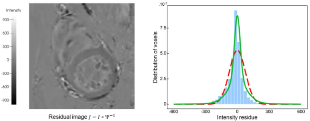 Figure 3.4: (Left) Example residual image after pairwise image registration, as per the example of Fig