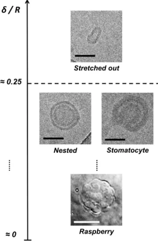 Figure  5.  Final morphology expected for  water-filled vesicles with a fluid membrane  submitted to a hypertonic stress as a  function of the membrane thickness /  vesicle radius ratio