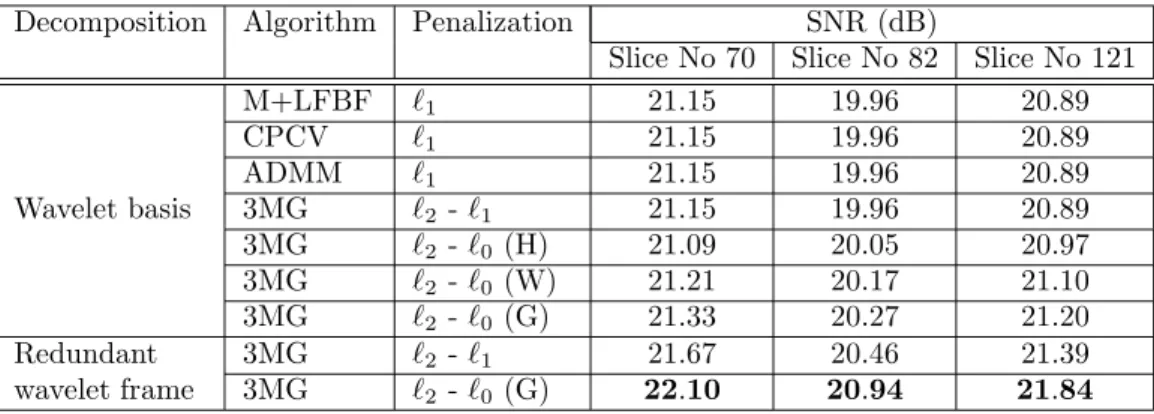 Table 2: Reconstruction results for several optimization and regularization strate- strate-gies using two diﬀerent decompositions (Poly1 subsampling pattern).
