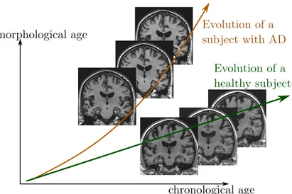 Figure 2.1: Schematic representation of two evolutions relative to an hypothetical morphological age reflecting the structural status of the brain relative to the aging process.