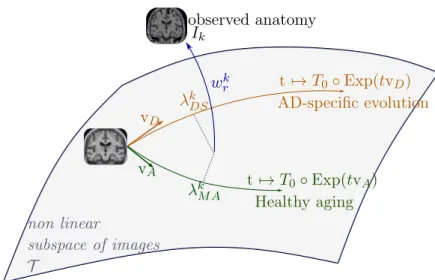 Figure 2.2: Our two-trajectory model. The template image T 0 , the normal aging template trajectory parametrized by v A and the disease specific template  trajec-tory parametrized by v D define a subspace of possible morphologies of reference.