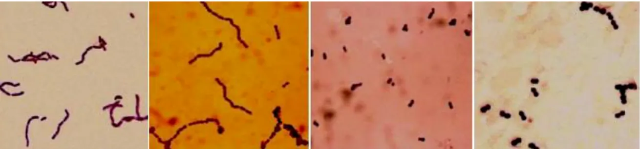 Figure  06:  Différentes  formes  microscopique  de  bactéries  lactiques  obtenues  au  laboratoire  de  microbiologie appliquée de l'université d'Oran par Saidi (2005)
