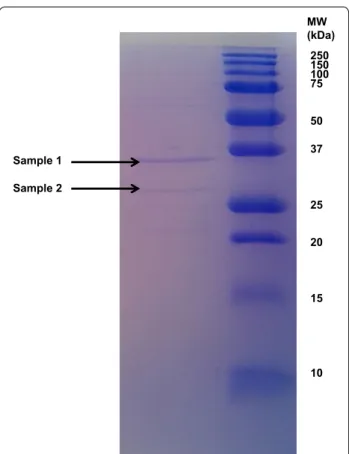 Fig. 1  The dialyzed proteolytic enzyme investigated on SDS‑PAGE  using a 12 % gel. Two bands at 36 and 28 kDa, respectively, were  excised for protein identification