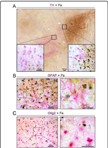 Fig. 4 Cellular localization of iron deposits in the substantia nigra. A – C Double-labeling of chemically stained iron ions (dark brown) along with immunohistochemically stained with TH (A), GFAP (B), or Olig2 (C) antibody (magenta) showed heavy iron depo