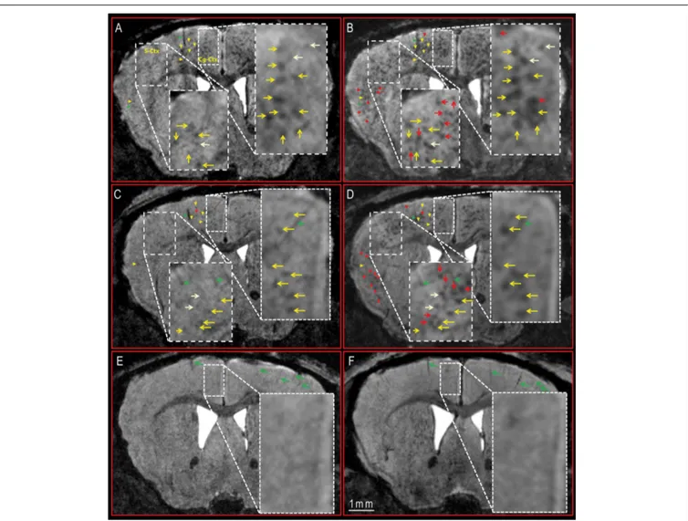 FIGURE 2 | Longitudinal follow-up of DM4 and SAR255952 treatments by MR imaging in APP/PS1 and PS1 mice