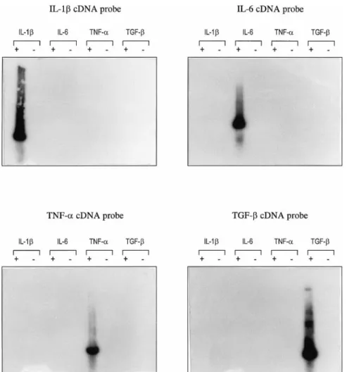 FIG. 2. Southern blotting experiment on amplification products obtained after RT-PCR using cytokine primers.