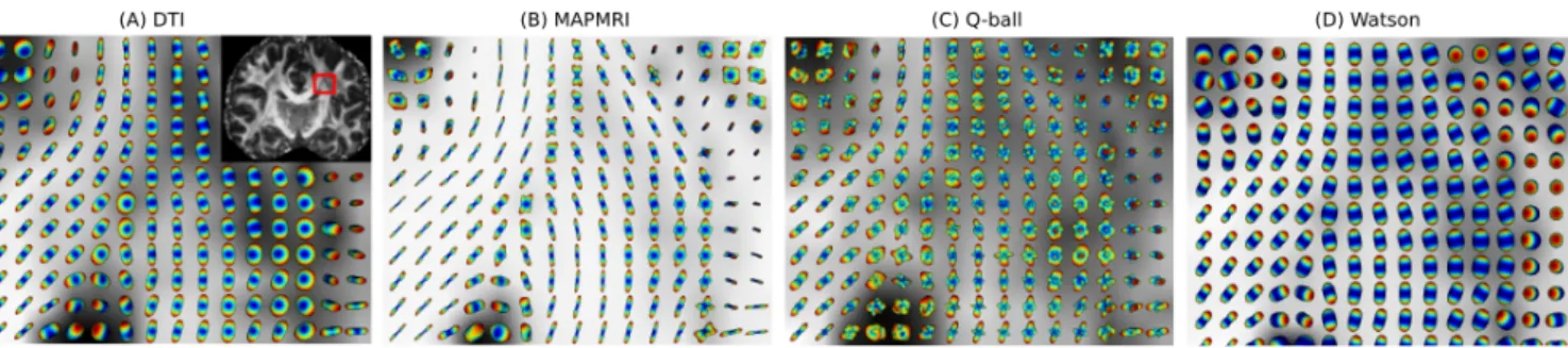 Figure 2.6: Comparison of different models in the reconstruction of diffusion signal: (A) Diffusion Tensor Imaging, (B) Mean Apparent Propagator (MAP)-MRI, (C) Q-Ball Imaging, and (D) Watson distributions of NODDI