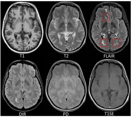 Fig. 2.1: MRI pulse sequences usually used in a clinical setting.
