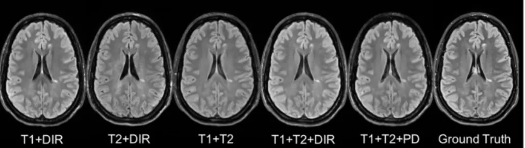 Fig. 2.7: Different Combinations of T1, T2, DIR and PD as input sequences.