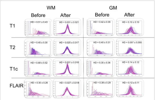 Figure 5.  Histograms of intensities in WM and GM before and after standardization for T1, T2, post injection T1 (T1c) and FLAIR  scans