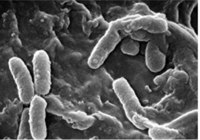 Figure 4: P. aeruginosa en microscopie électronique