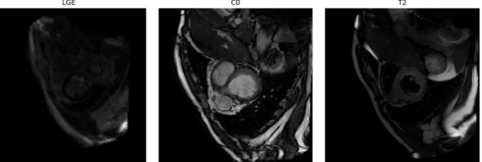 Fig. 3: Short-axis view of original LGE, C0 and T2 CMR images. Note that despite having different contrasts, all these images show the same anatomical structure.