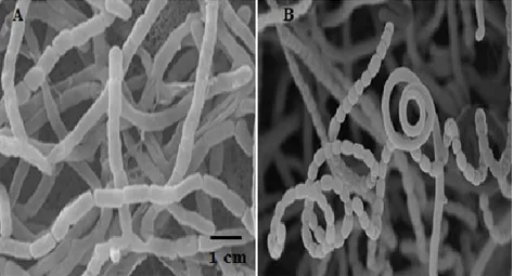 Fig. 2 : Vue au microscope électronique à balayage des types mycélium des actinomycètes
