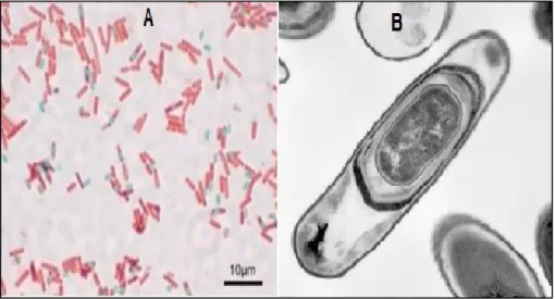 Fig. 13 : B. subtilis observé en microscopie électronique(5). 