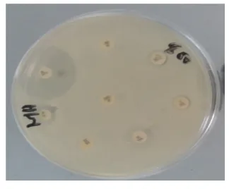 Figure 9 : Résultat de l’API staph 