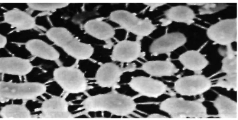 Figure 17. Fixation des Leuconostocs sur les moules en grès-vernissé.#(Examen en  microscopie électronique de balayage, 11 500×).#Photo Micheline Rousseau - Christiane Le 