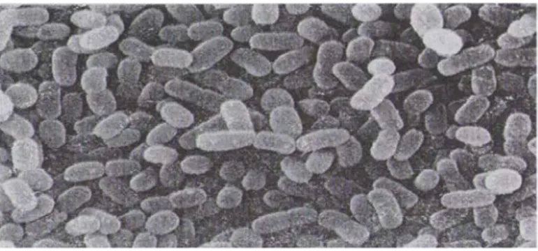 Figure 19. Morphologie en microscopie électronique de Bifidobacterium animalis#Photo 
