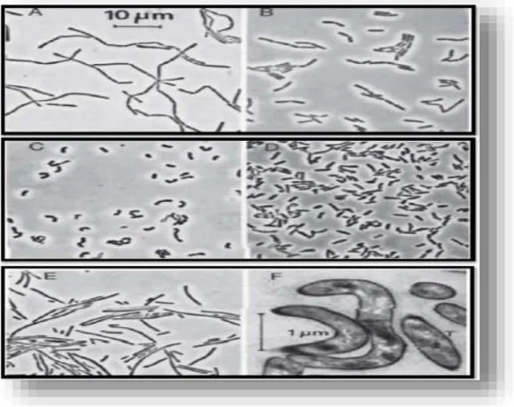 Figure  03 :  Contraste  de  phase  (A-E)  et  d'électrons  (F)  des  micrographies  montrant  la  différence  de  morphologie  des  cellules  de  Lactobacilles
