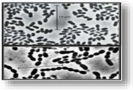 Figure 05: Lactococcus lactis subsp lactis sous forme de cellules ovoïdes par paire (photo du  haut), et en chainette (photo du bas) selon la souche (Teuber et Geis, 2006)