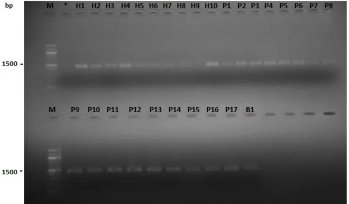 Figure 15:Amplification  des séquences de l'ADNr 16S réalisée avec de l’ADN génomique
