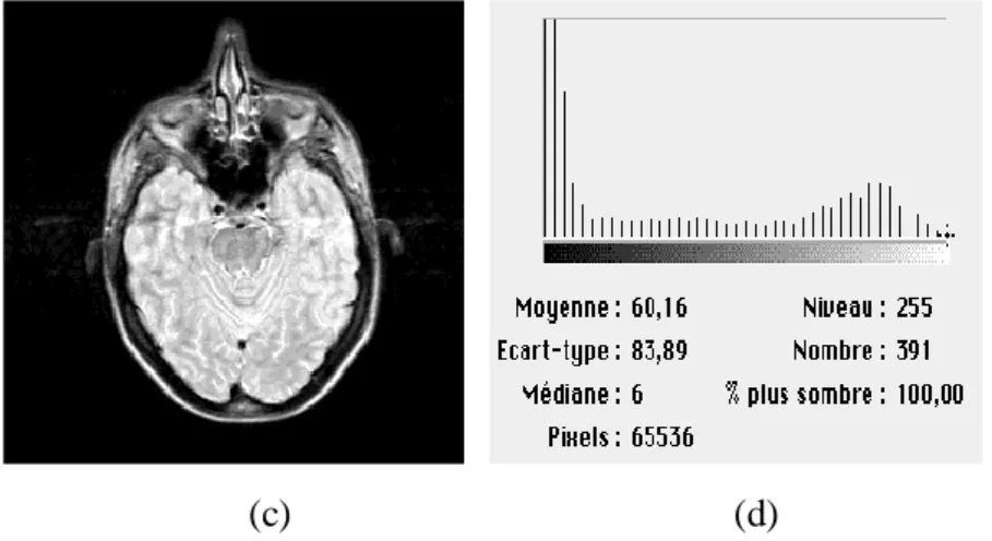 Fig. I.9 : Augmentation du contraste d’une image par étirement d’histogramme. 