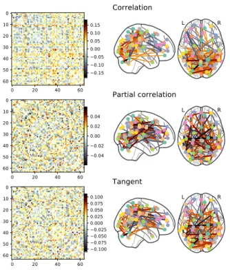 Figure A1: Difference between mean of MCI and AD group connectivity matrices: We show the connectivity matrices from the ADNI dataset computed on samples diagnosed as Mild  Cogni-tive Impairment (MCI) and Alzheimer’s disease (AD)