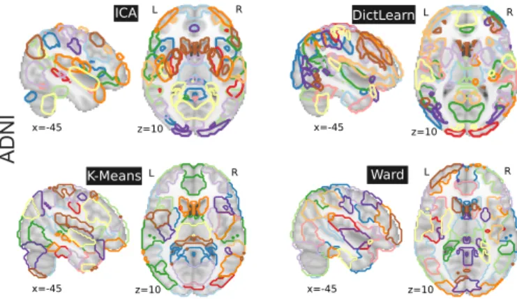 Figure 2: Brain regions extracted with ICA, DictLearn, KMeans, and Ward For ICA and dictionary learning, the  dimen-sionality is of 80 and 60 resting-state networks – which are then  bro-ken up into more regions – yielding 150 regions, and 120 for KMeans a