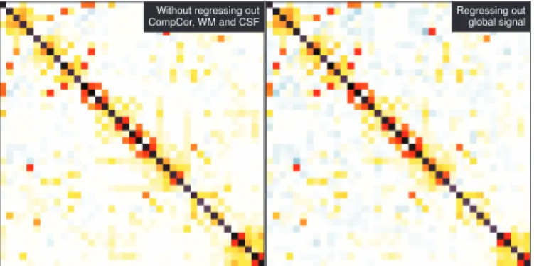 Figure 4: Inverse-covariance matrices for different choice of con- con-found regressors – Left: regressing out only movement parameters – Right: removal of the global mean, instead of the white matter, CSF, and CompCor time courses.
