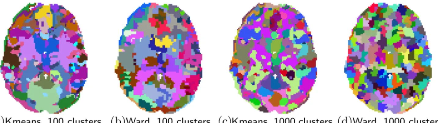 Figure 5: Brain parcellations extracted by clustering. Colors are random.