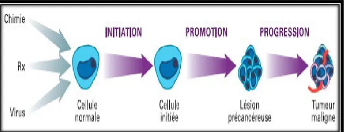 Figure 1 : représente le processus de formation d’un cancer. (Centre François Baclesse,  Centre de lutte contre le cancer de Basse ‐ Normandie) 